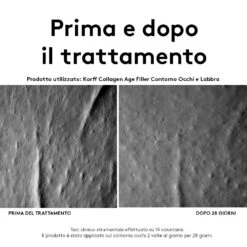 KORFF Collagen Age Filler Contorno Occhi E Labbra -Dr. Hauschka Negozio IT979401193 p3